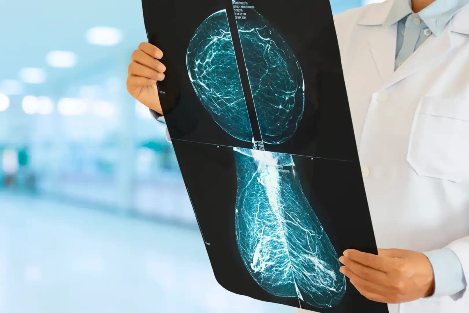 Pós-Graduação EAD em ABORDAGEM MULTIDISCIPLINAR EM ONCOLOGIA