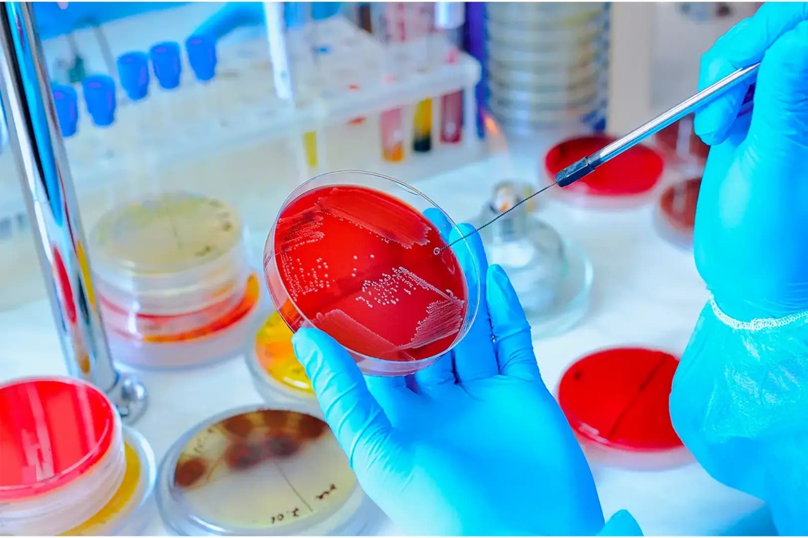 Pós-Graduação EAD em IMUNOLOGIA E MICROBIOLOGIA