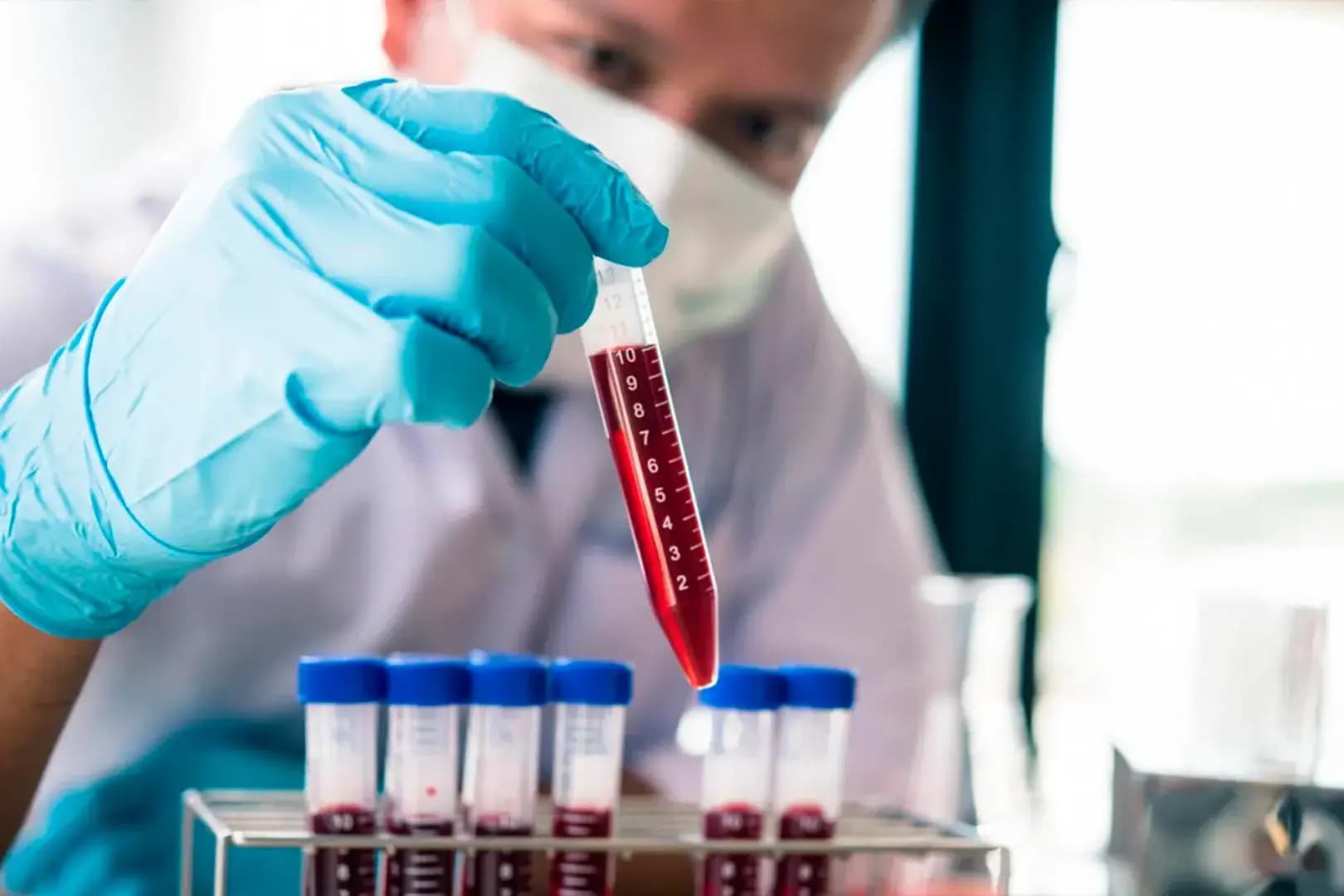 Pós-Graduação EAD em HEMATOLOGIA E IMUNO-HEMATOLOGIA